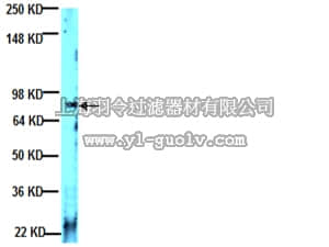 merck millipore,默克密理博,MAB1922,Anti-Laminin α2 Antibody, clone 5H2
