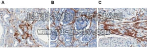 merck millipore,默克密理博,MAB1949,Anti-Laminin-5 Antibody, clone P3E4