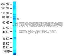merck millipore,默克密理博,MAB2160,Anti-Fragile X Mental Retardation Protein Antibody, clone 1C3