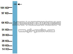 merck millipore,默克密理博,MAB2166,Anti-Huntingtin Protein Antibody, a.a. 181-810, clone 1HU-4C8