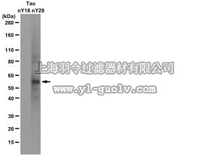 merck millipore,默克密理博,MAB2244,Anti-Nitrated Tau (Tyr29) Antibody, clone Tau-nY29