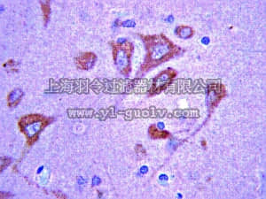 merck millipore,默克密理博,MAB2265,Anti-Peripheral Myelin Protein 22 (PMP22) Antibody, clone CF1