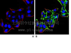 merck millipore,默克密理博,MAB2609,Anti-beta Arrestin 1 Antibody, clone 3H11.2