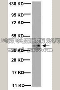 merck millipore,默克密理博,MAB302,Anti-Glutamine Synthetase Antibody, clone GS-6