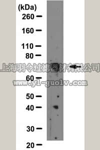 merck millipore,默克密理博,MAB3308,Anti-MMP-2 Antibody, a.a. 468-483 hMMP2, clone 42-5D11