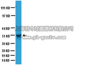 merck millipore,默克密理博,MAB3402,Anti-Glial Fibrillary Acidic Protein Antibody, clone GA5