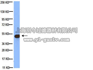 merck millipore,默克密理博,MAB3408,Anti-Tubulin Antibody, beta, clone KMX-1