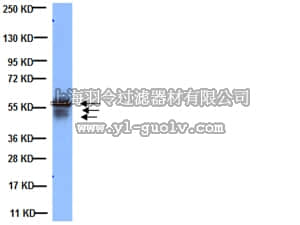 merck millipore,默克密理博,MAB3412,Anti-Cytokeratin AE1/AE3 Antibody, recognizes acidic & basic cytokeratins, clone AE1/AE3