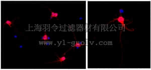 merck millipore,默克密理博,MAB3418A5,Anti-MAP2 Antibody, clone AP20, Alexa Fluor 555 Conjugate