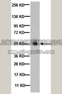merck millipore,默克密理博,MAB341,Anti-GABA A Receptor β 2,3 Chain Antibody, clone BD17