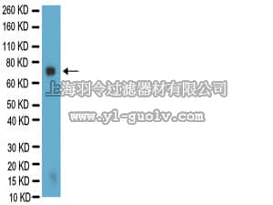 merck millipore,默克密理博,MAB342,Anti-Galactocerebroside Antibody, clone mGalC