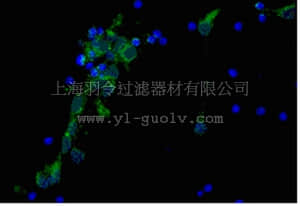 merck millipore,默克密理博,MAB348B,Anti-Alzheimer Precursor Protein A4 Antibody, clone 22C11, Biotin Conj.,MAB348B