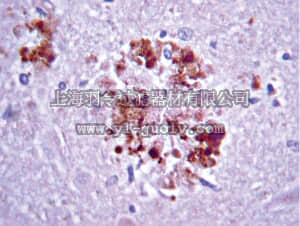 merck millipore,默克密理博,MAB348,Anti-APP A4 Antibody, a.a. 66-81 of APP {NT}, clone 22C11