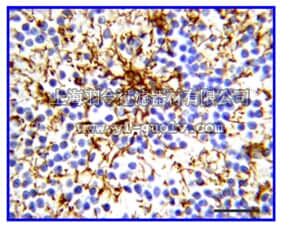 merck millipore,默克密理博,MAB360,Anti-Glial Fibrillary Acidic Protein Antibody, clone GA5