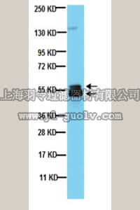 merck millipore,默克密理博,MAB3747-I,Anti-Microphthalmia (Mi) Antibody, clone C5