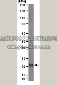merck millipore,默克密理博,MAB4418,Anti-Achaete Scute homolog 2 Antibody, clone 7E2