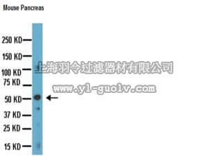 merck millipore,默克密理博,MAB5268,Anti-Chromogranin A Antibody, clone LK2H10