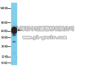 merck millipore,默克密理博,MAB5280,Anti-Tyrosine Hydroxylase Antibody, clone 2/40/15