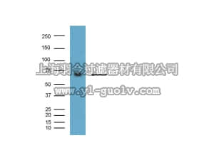 merck millipore,默克密理博,MAB5308,Anti-BACE Antibody, CT, clone 61-3E7