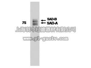 merck millipore,默克密理博,MAB5798,Anti-SAD A/B Antibody, clone 11A5