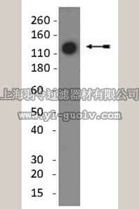 merck millipore,默克密理博,MAB8887,Anti-Collagen Type II Antibody, clone 6B3