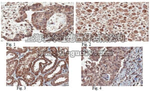 merck millipore,默克密理博,MABC111,Anti-STK3/MST2 Antibody, clone 9G7.1