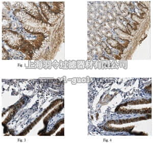 merck millipore,默克密理博,MABC121,Anti-ALDH3A1, clone 10C7.1 Antibody