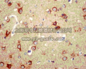merck millipore,默克密理博,MABC136,Anti-ATG4A Antibody, clone EPR4122, rabbit monoclonal