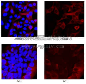 merck millipore,默克密理博,MABC154,Anti-RRM2 Antibody, clone 4D1.2