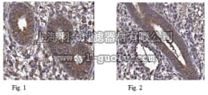 merck millipore,默克密理博,MABC158,Anti-hyaluronan synthase 1 Antibody, clone 12A2.3