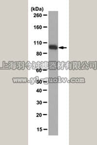 merck millipore,默克密理博,MABC171,Anti-Isocitrate Dehydrogenase 1 (IDH1)-R132H Antibody, clone HMab-1