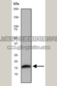 merck millipore,默克密理博,MABC175,Anti-LC3A Antibody, clone EPR1754, rabbit monoclonal