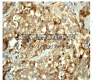 merck millipore,默克密理博,MABC176,Anti-LC3A/B (NT) Antibody, clone EP1983Y, rabbit monoclonal