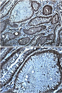merck millipore,默克密理博,MABC36,Anti-Dog1 Antibody, clone 1.1