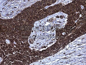 merck millipore,默克密理博,MABC42,Anti-Pleiotrophin Antibody, clone 3B10