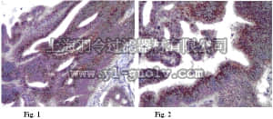 merck millipore,默克密理博,MABC44,Anti-LAMP-3 Antibody, clone 16H11.2