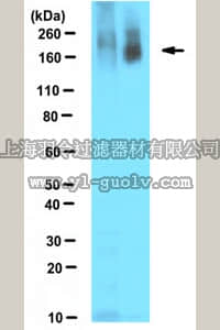 merck millipore,默克密理博,MABC547,Anti-Poly ADP-ribose Antibody, clone 10H