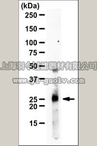 merck millipore,默克密理博,MABC637,Anti-HAND1 Antibody, clone 8E7A11