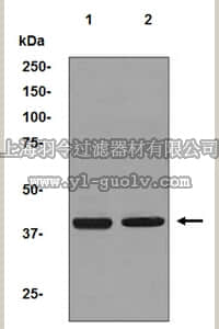 merck millipore,默克密理博,MABC642,Anti-PTGFR Antibody, clone EPR5844, rabbit monoclonal