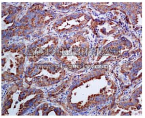 merck millipore,默克密理博,MABC643,Anti-Napsin A Antibody, clone EPR6252, rabbit monoclonal