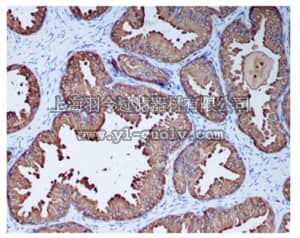 merck millipore,默克密理博,MABC645,Anti-PSP94 Antibody, clone EPR7345, rabbit monoclonal