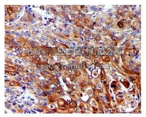merck millipore,默克密理博,MABC646,Anti-SCCA Antibody, clone EPR5157, rabbit monoclonal