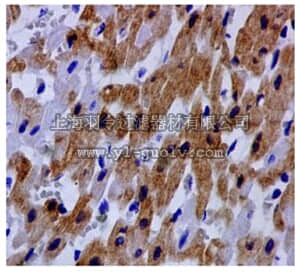 merck millipore,默克密理博,MABC647,Anti-SFRP Antibody1, clone EPR7003, rabbit monoclonal