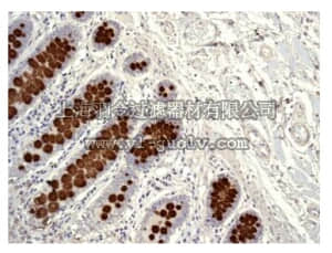 merck millipore,默克密理博,MABC655,Anti-MUC2 Antibody, clone EPR6144, rabbit monoclonal