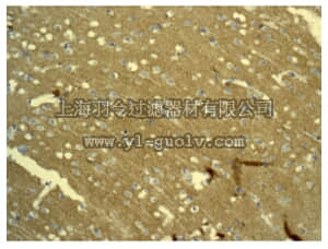 merck millipore,默克密理博,MABC678,Anti-Gli-1 Antibody, clone EPR4523, rabbit monoclonal