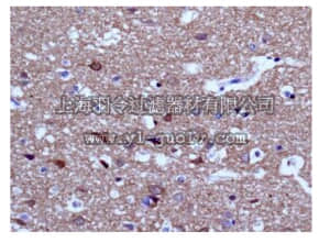 merck millipore,默克密理博,MABC685,Anti-ENC1 Antibody, clone EPR5406(B), rabbit monoclonal