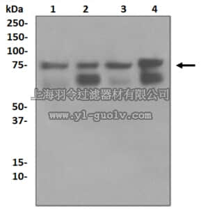 merck millipore,默克密理博,MABC688,Anti-RIP Antibody, clone EPR4689, rabbit monoclonal