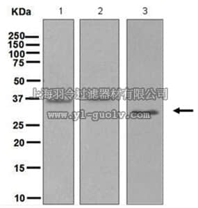 merck millipore,默克密理博,MABC738,Anti-Stanniocalcin-1, clone EPR6055, Rabbit Monoclonal Antibody