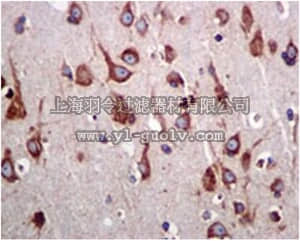 merck millipore,默克密理博,MABC744,Anti-CARD9, clone EPR6488, Rabbit Monoclonal Antibody