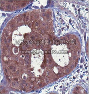merck millipore,默克密理博,MABC74,Anti-BNIPL-2 Antibody, clone 8C11.1